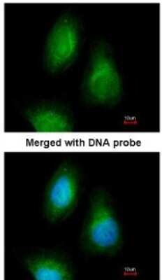 Immunocytochemistry/ Immunofluorescence: SEPHS2 Antibody [NBP1-32645]