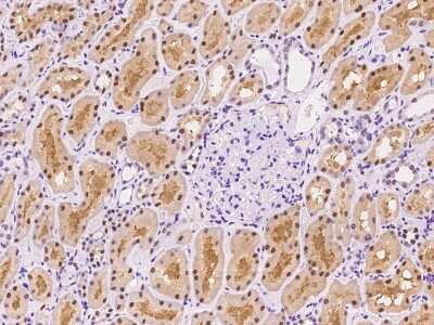 Immunohistochemistry-Paraffin: SEPHS2 Antibody [NBP2-97672]