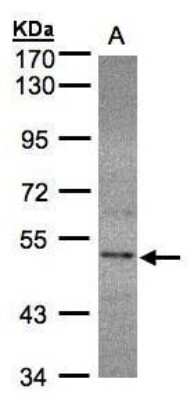 Western Blot: SEPHS2 Antibody [NBP1-32645]