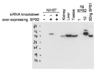 Western Blot: SEPHS2 Antibody [NBP1-77776]