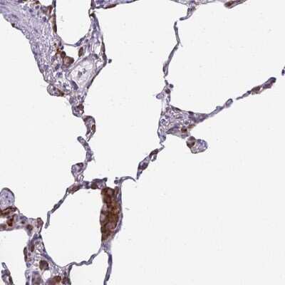 Immunohistochemistry-Paraffin: SEPN1 Antibody [NBP2-34098]