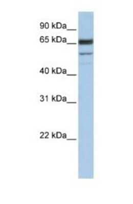 Western Blot: SEPN1 Antibody [NBP1-79247]