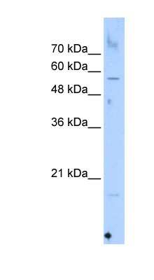 Western Blot: SEPN1 Antibody [NBP1-79248]