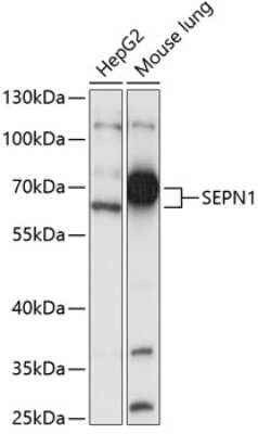 Western Blot: SEPN1 AntibodyAzide and BSA Free [NBP3-04974]