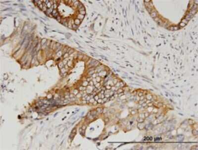 Immunohistochemistry-Paraffin: SERBP1 Antibody (1G5-2D7) [H00026135-M02]