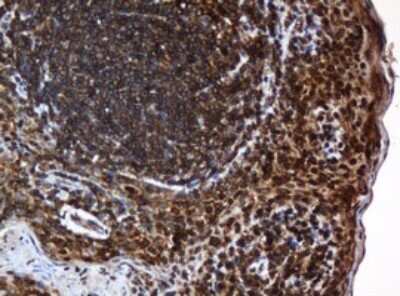 Immunohistochemistry: SERBP1 Antibody (OTI5G2) [NBP2-45763]