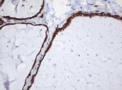 Immunohistochemistry: SERBP1 Antibody (OTI5G2) [NBP2-45763]
