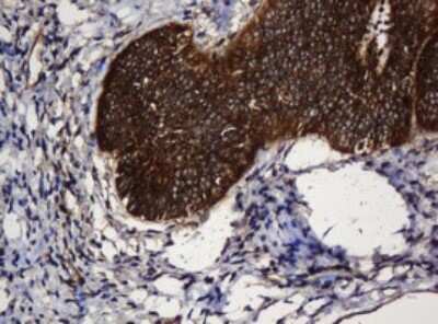 Immunohistochemistry: SERBP1 Antibody (OTI5G2) [NBP2-45763]