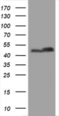 Western Blot: SERBP1 Antibody (OTI5G2) [NBP2-45763]