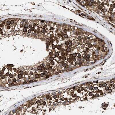 Immunohistochemistry-Paraffin: SERBP1 Antibody [NBP1-85660]