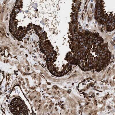 Immunohistochemistry-Paraffin: SERBP1 Antibody [NBP1-85660]