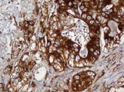Immunohistochemistry: SERBP1 Antibody (OTI5G2) - Azide and BSA Free [NBP2-74073]