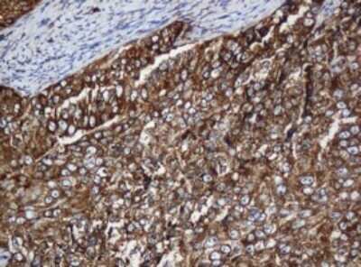 Immunohistochemistry: SERBP1 Antibody (OTI5G2) - Azide and BSA Free [NBP2-74073]