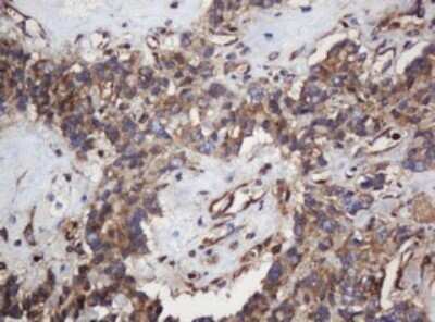 Immunohistochemistry: SERBP1 Antibody (OTI5G2) - Azide and BSA Free [NBP2-74073]