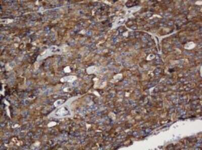 Immunohistochemistry: SERBP1 Antibody (OTI5G2) - Azide and BSA Free [NBP2-74073]