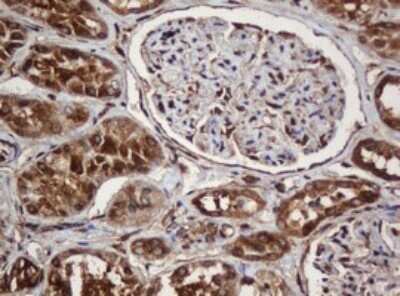 Immunohistochemistry: SERBP1 Antibody (OTI5G2) - Azide and BSA Free [NBP2-74073]