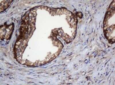 Immunohistochemistry: SERBP1 Antibody (OTI5G2) - Azide and BSA Free [NBP2-74073]
