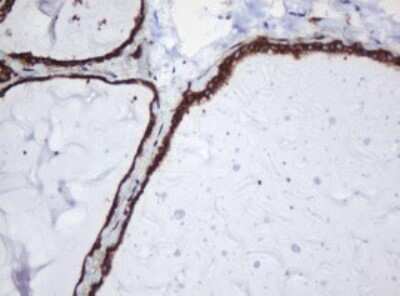 Immunohistochemistry: SERBP1 Antibody (OTI5G2) - Azide and BSA Free [NBP2-74073]