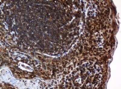 Immunohistochemistry: SERBP1 Antibody (OTI5G2) - Azide and BSA Free [NBP2-74073]
