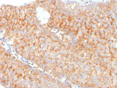 Immunohistochemistry-Paraffin: SERBP1 Antibody (SERBP1/3491) [NBP3-07610]
