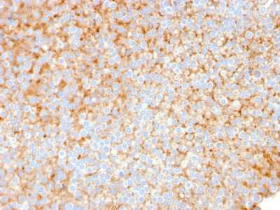 Immunohistochemistry-Paraffin: SERBP1 Antibody (SERBP1/3491) [NBP3-07610]