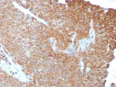 Immunohistochemistry-Paraffin: SERBP1 Antibody (SERBP1/3493) - Azide and BSA Free [NBP2-79939]