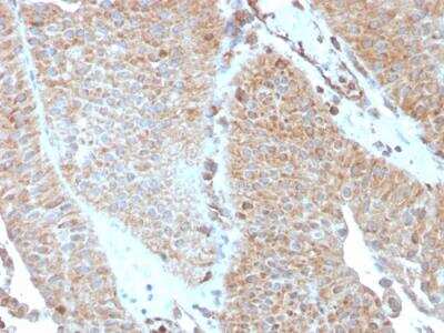 Immunohistochemistry-Paraffin: SERBP1 Antibody (SERBP1/3493) - Azide and BSA Free [NBP2-79939]