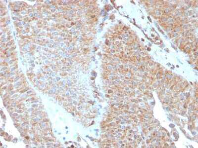 Immunohistochemistry-Paraffin: SERBP1 Antibody (SERBP1/3493) [NBP2-79805]