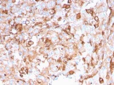 Immunohistochemistry-Paraffin: SERBP1 Antibody (SERBP1/3496) - Azide and BSA Free [NBP2-79844]