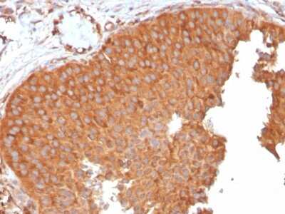 Immunohistochemistry-Paraffin: SERBP1 Antibody (SERBP1/3496) [NBP2-79710]