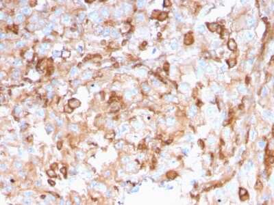 Immunohistochemistry-Paraffin: SERBP1 Antibody (SERBP1/3496) [NBP2-79710]