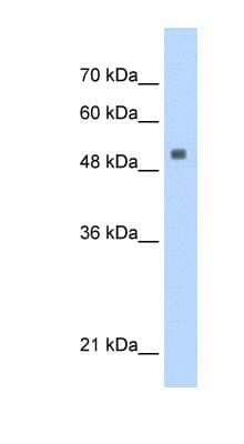 Western Blot: SERBP1 Antibody [NBP1-57211]