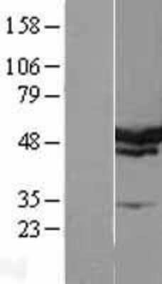 Western Blot: SERBP1 Overexpression Lysate [NBL1-15821]