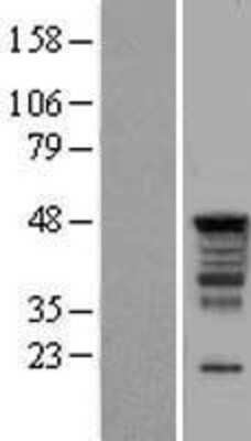 Western Blot: SERBP1 Overexpression Lysate [NBL1-15823]