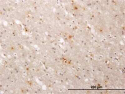 Immunohistochemistry-Paraffin: SERCA1 ATPase Antibody (1B11) [H00000487-M01]