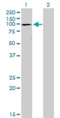 Western Blot: SERCA1 ATPase Antibody (1B11) [H00000487-M01]