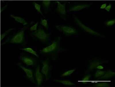 Immunocytochemistry/ Immunofluorescence: SERCA1 ATPase Antibody (2C7) [H00000487-M03]