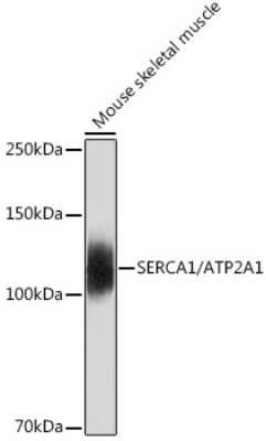 Western Blot: SERCA1 ATPase Antibody (2T8S3) [NBP3-15830]