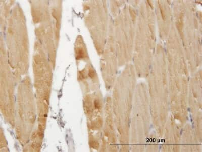 Immunohistochemistry-Paraffin: SERCA1 ATPase Antibody (4B8) [H00000487-M05]