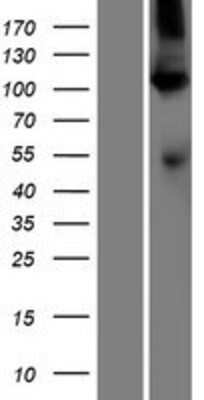 Western Blot: SERCA1 ATPase Overexpression Lysate [NBP2-05144]