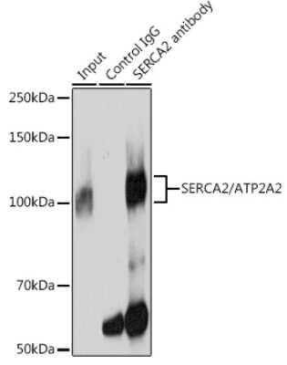 Immunoprecipitation: SERCA2 ATPase Antibody (10F0M9) [NBP3-15429]