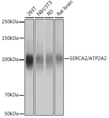 Western Blot: SERCA2 ATPase Antibody (10F0M9) [NBP3-15429]