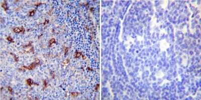 Immunohistochemistry-Paraffin: SERCA2 ATPase Antibody (IID8) - BSA Free [NB300-529]