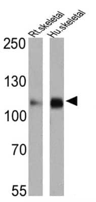 Western Blot: SERCA2 ATPase Antibody (IID8)BSA Free [NB300-529]