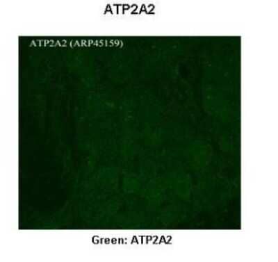 Immunohistochemistry: SERCA2 ATPase Antibody [NBP1-59203]