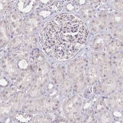 Immunohistochemistry-Paraffin: SERCA2 ATPase Antibody [NBP2-34147]