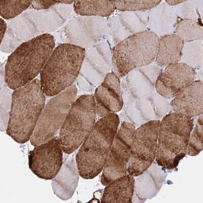 Immunohistochemistry-Paraffin: SERCA2 ATPase Antibody [NBP2-34147]