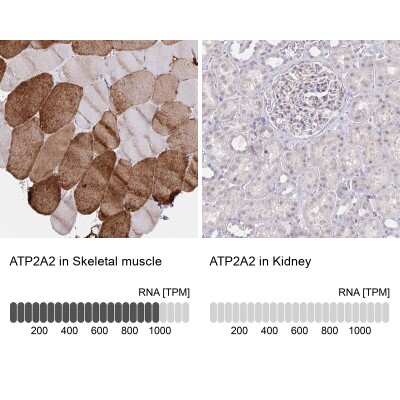 Immunohistochemistry-Paraffin: SERCA2 ATPase Antibody [NBP2-34147]