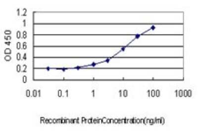 ELISA: SERCA3 ATPase Antibody (2H3) [H00000489-M01]