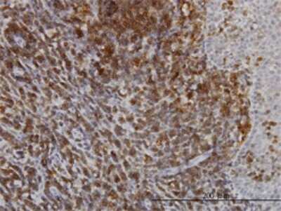 Immunohistochemistry-Paraffin: SERCA3 ATPase Antibody (2H3) [H00000489-M01]